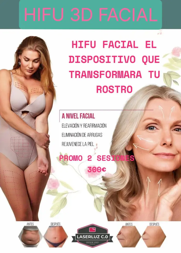 HIFU Facial